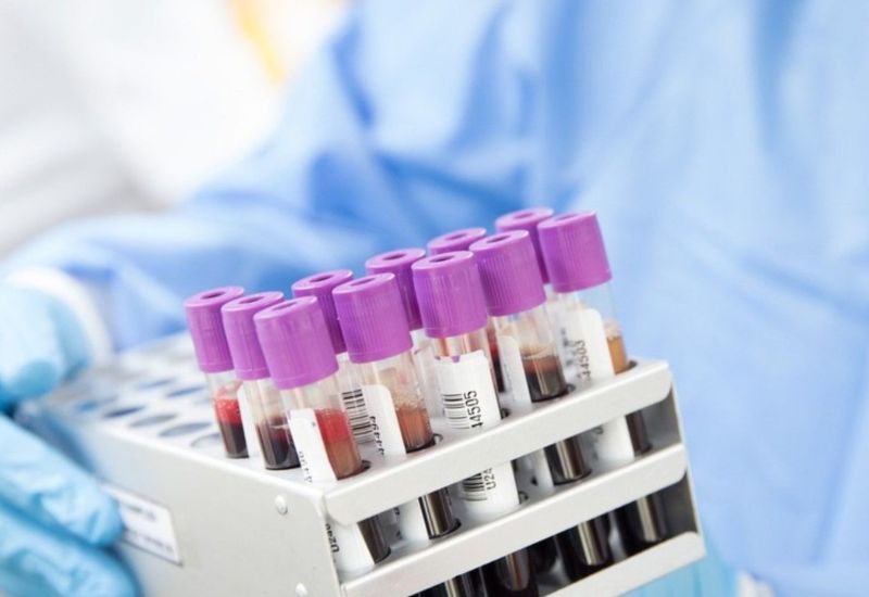 Xét nghiệm máu CMP