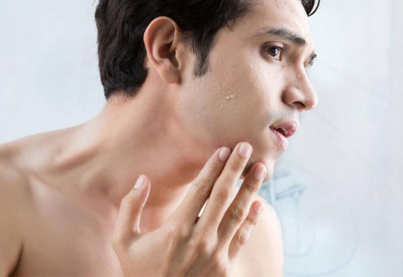 Kích thích mọc râu