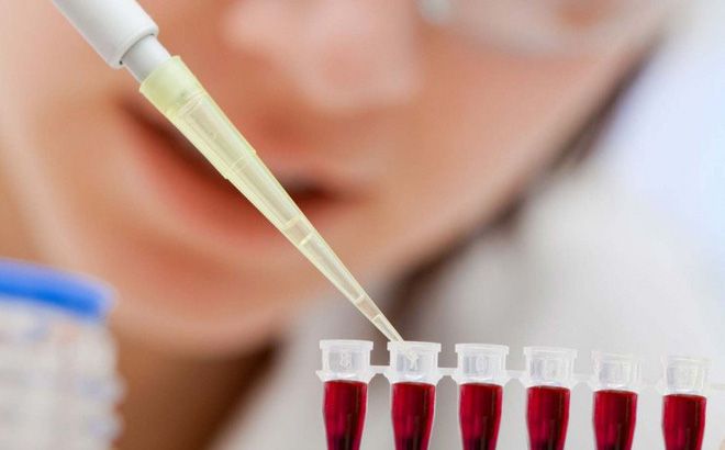 Tiêm tế bào gốc