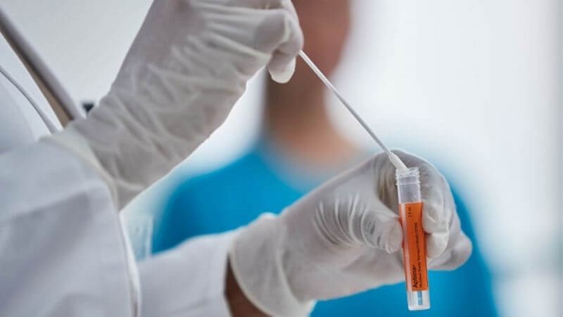 xét nghiệm nhiễm khuẩn âm đạo