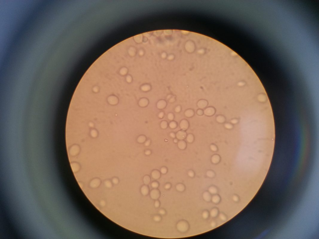 nhiễm trùng nấm men