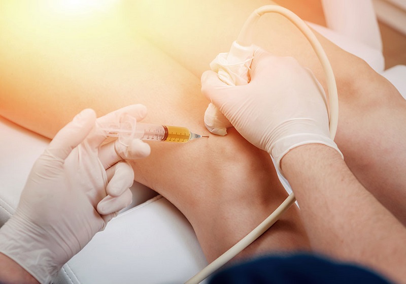 Tiêm tế bào gốc