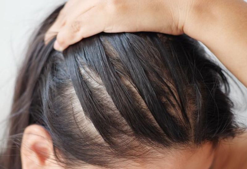 biotin trị rụng tóc