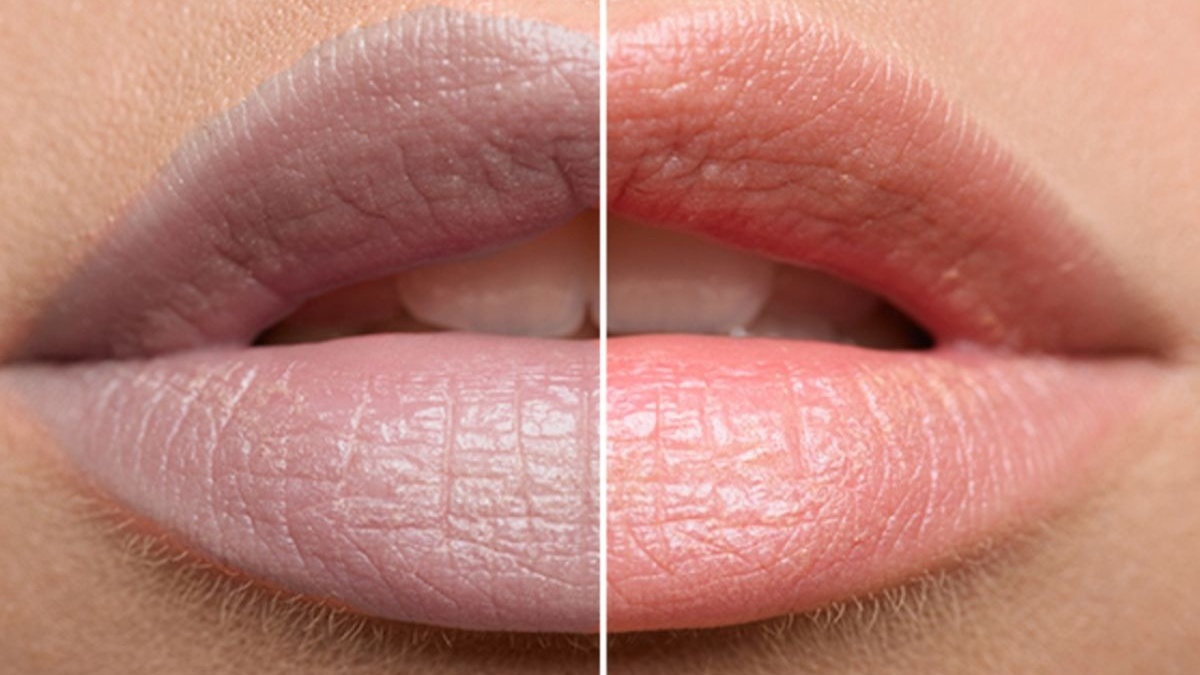 môi đổi màu và thiếu máu