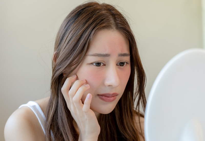 bề mặt da sần sùi