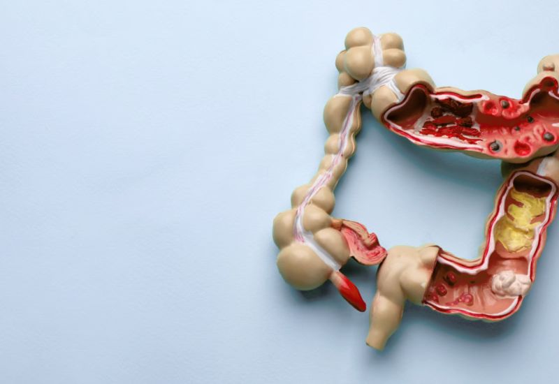 cách thải độc ruột