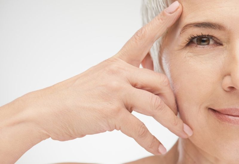 da chùng nhão chảy xệ