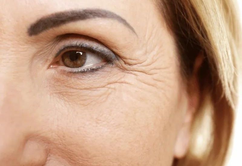 làm sao hết nếp nhăn ở mắt