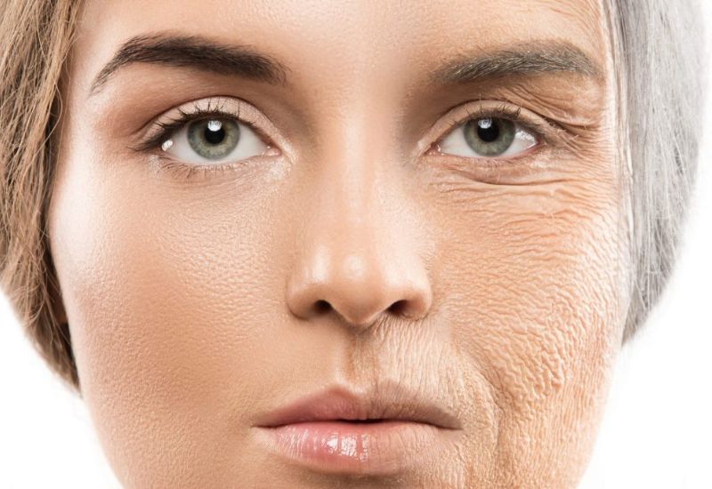 vùng da bị chùng nhão