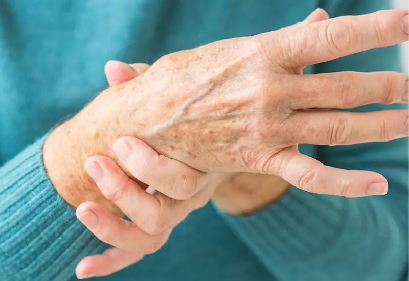 hội chứng cổ tay có phải bệnh thần kinh