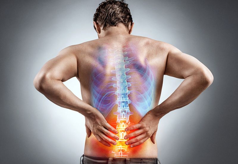 bệnh viêm rễ thần kinh