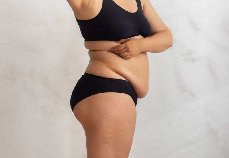 da chùng nhão sau giảm cân