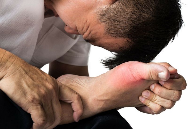 nhiễm độc chất urat