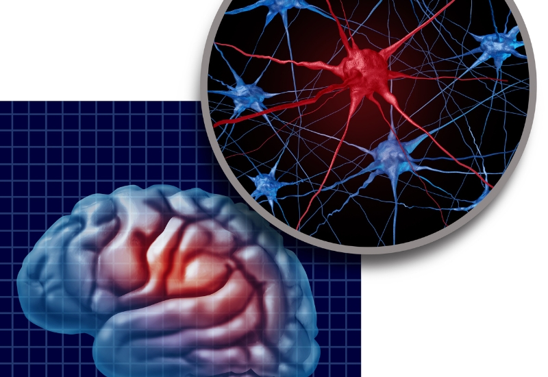 rối loạn dẫn truyền thần kinh