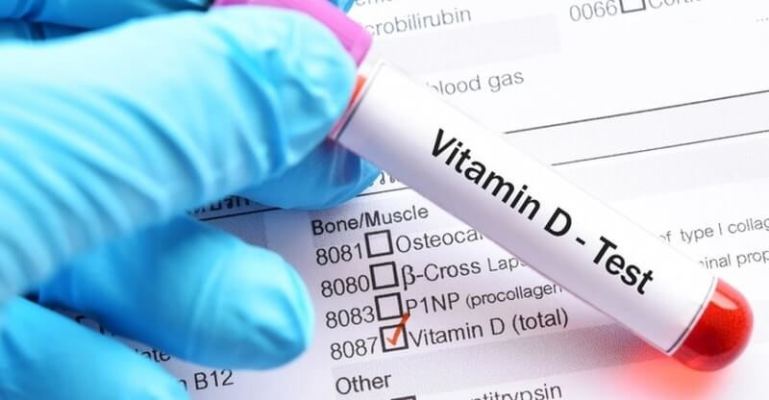chi-so-xet-nghiem-vitamin-d3
