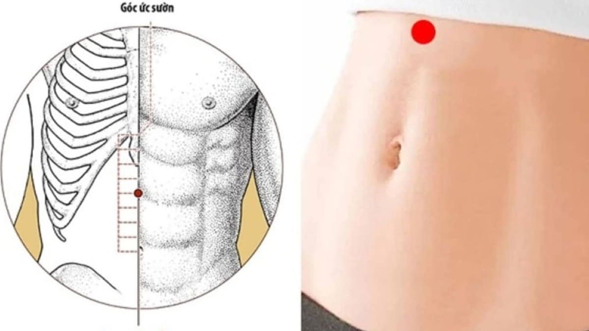 Bấm huyệt giảm đau dạ dày