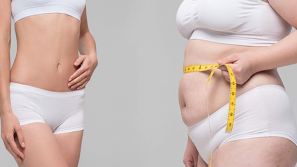 Cách nhận biết thừa cân béo phì