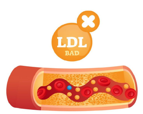 chi-so-ldl-cholesterol-bao-nhieu-la-binh-thuong-muc-an-toan-nguy-hiem-va-cach-kiem-soat