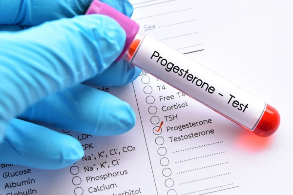 chi-so-progesterone-bao-nhieu-la-binh-thuong