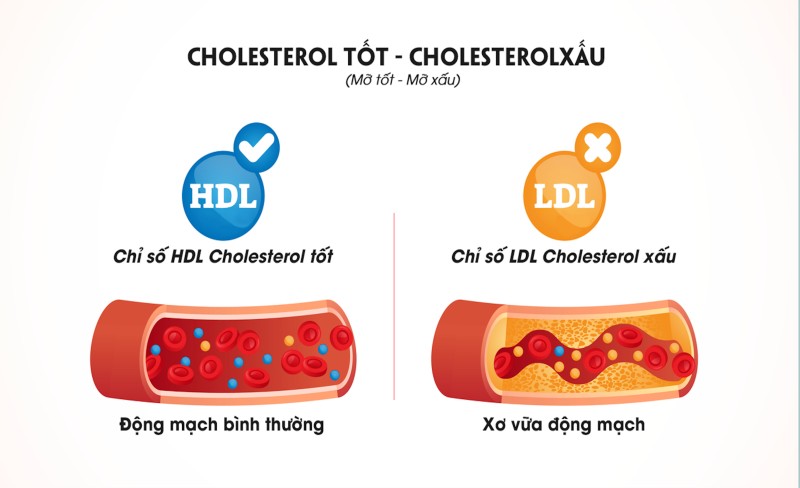 Chỉ số HDL cholesterol tốt và LDL cholesterol xấu (Ảnh: Sưu tầm Internet)