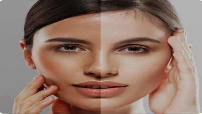 da thiếu sức sống