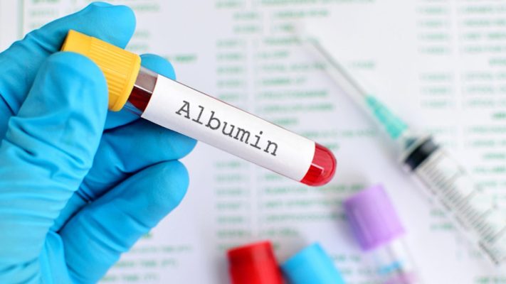 Albumin là chất gì