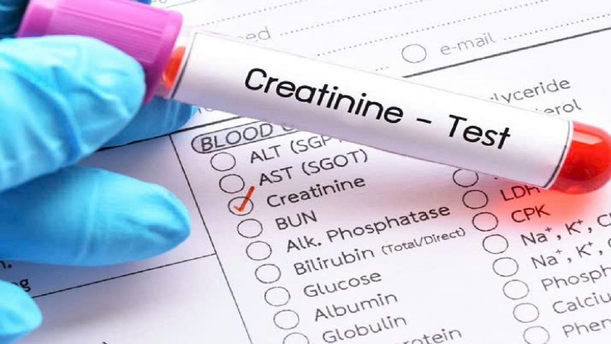 Chỉ số creatinin bình thường là bao nhiêu