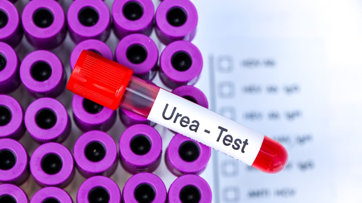 Chỉ số ure máu là gì