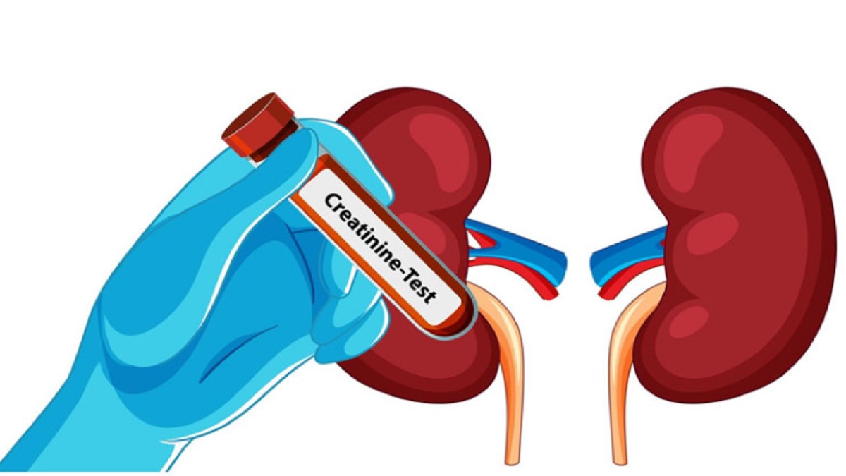 Bật mí cách giảm chỉ số creatinin hiệu quả và an toàn