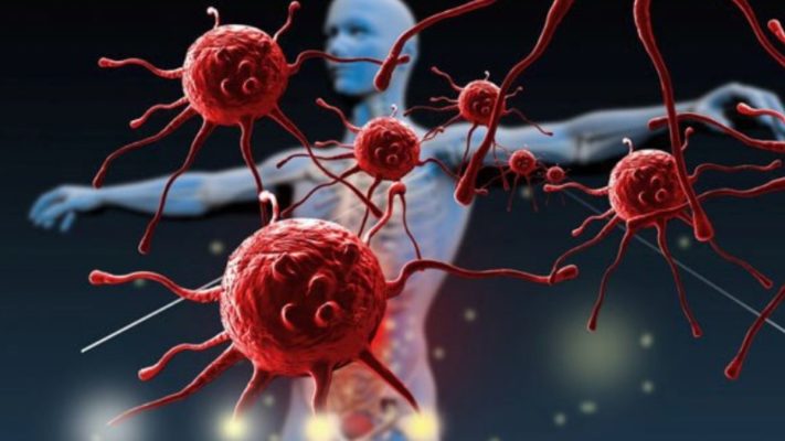 Hệ miễn dịch chống ung thư như thế nào?