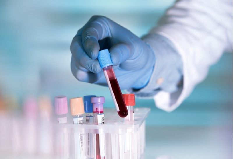 Xét nghiệm sẽ giúp bạn hiểu kháng insulin là như thế nào (Ảnh: Sưu tầm Internet)