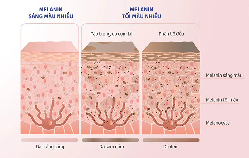 Sản xuất melanin không diễn ra tự do mà được điều hòa bởi nhiều yếu tố (Ảnh: Sưu tầm Internet)