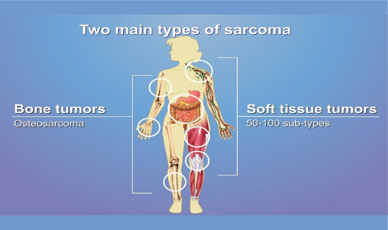 Sarcomere là đơn vị cấu trúc và chức năng cơ bản của cơ xương và cơ tim (Ảnh: Sưu tầm Internet)