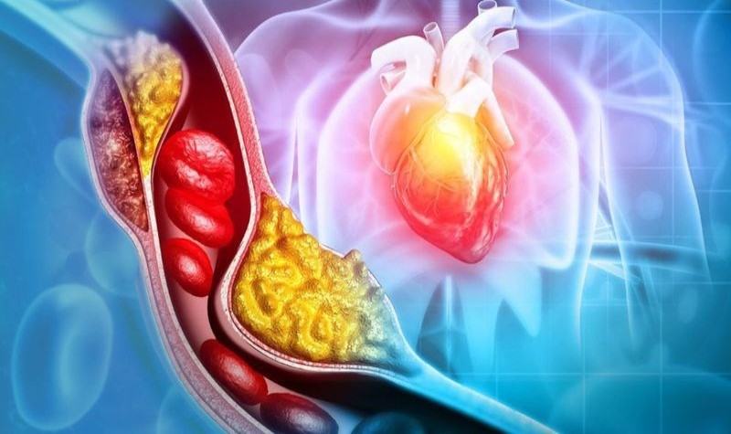 Sự cân bằng giữa LDL và HDL là yếu tố quyết định sức khỏe tim mạch (Ảnh: Sưu tầm Internet)