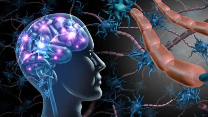 Thoái hóa thần kinh là gì