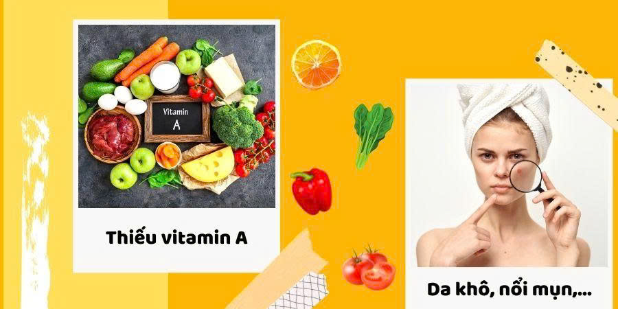 Uống vitamin A có tác dụng gì cho da mặt là băn khoăn của nhiều người (Ảnh: Sưu tầm Internet)
