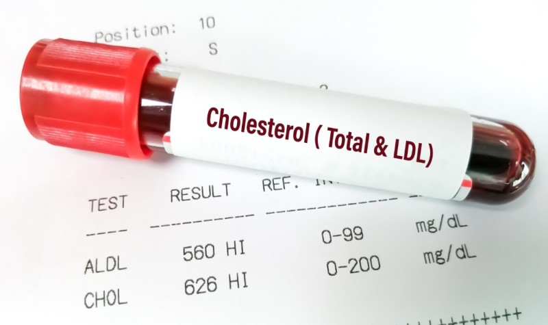 Xét nghiệm Chỉ số LDL Cholesterol để đánh giá nguy cơ tim mạch (Ảnh sưu tầm Internet)