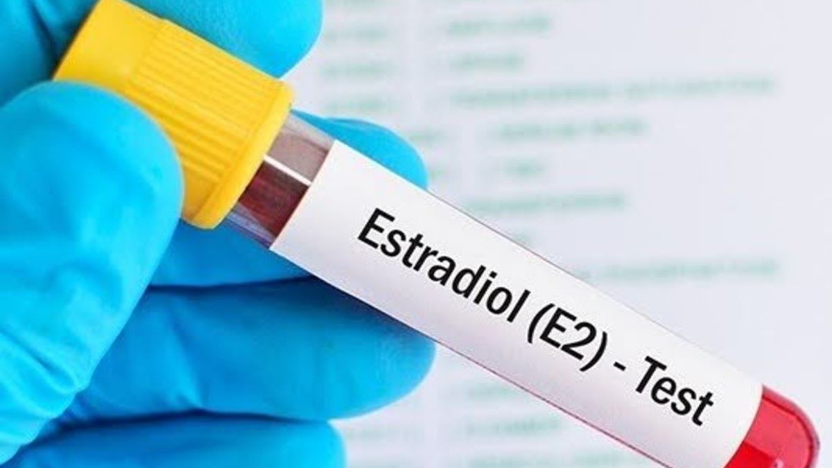 Xét nghiệm Estradiol để làm gì – Hiểu đúng để theo dõi sức khỏe nội tiết tố nữ