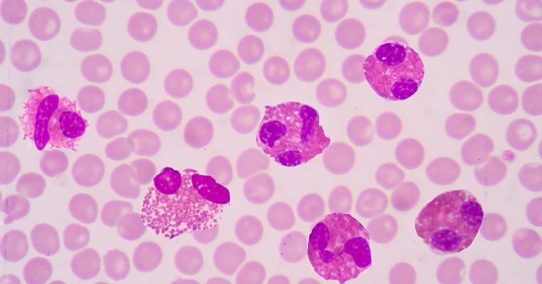 Bạch cầu ái toan: Vai trò, ý nghĩa và những điều cần biết