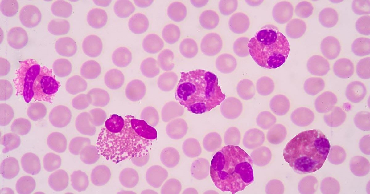 Bạch cầu ái toan: Vai trò, ý nghĩa và những điều cần biết