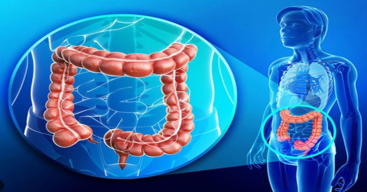 Có nên thải độc đại tràng? Hiểu đúng để tránh hại đại tràng
