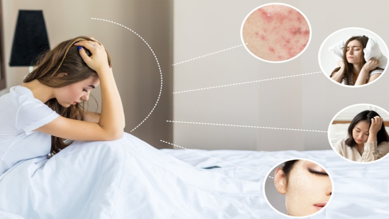 Tác hại của kinh nguyệt không đều sau sinh gây ra những ảnh hưởng tâm lý như căng thẳng (Ảnh:Sưu tầm Internet)