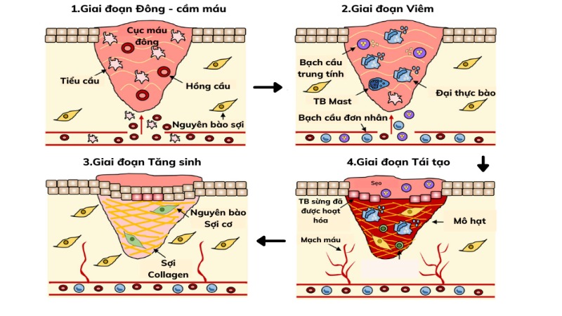 Quá trình lành vết thương là một chuỗi sự kiện sinh học được điều phối chặt chẽ (Ảnh: Sưu tầm Internet)