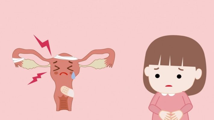 Nguyên nhân suy giảm buồng trứng sớm