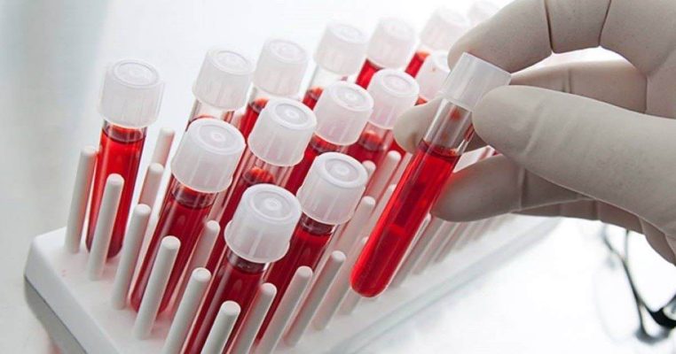 Xét nghiệm suy giảm miễn dịch: Khi nào cần thực hiện?