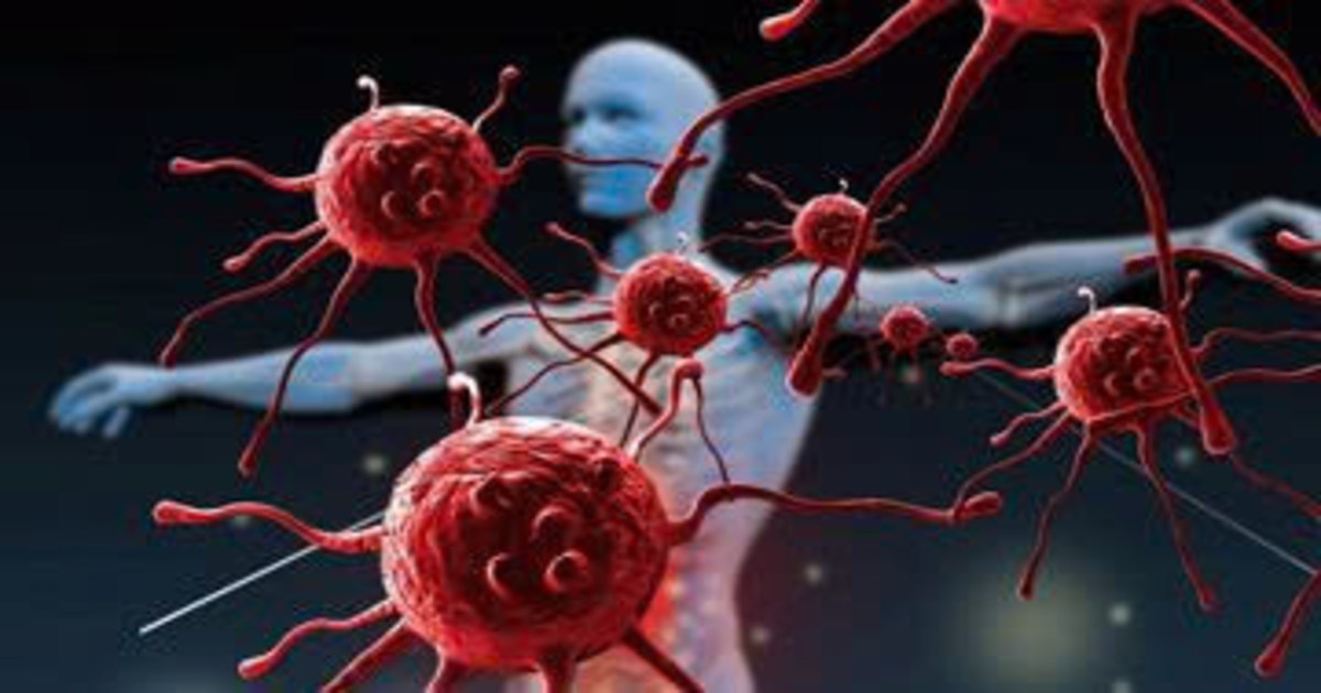 Suy giảm miễn dịch thứ phát – Hiểu đúng để phòng ngừa sớm