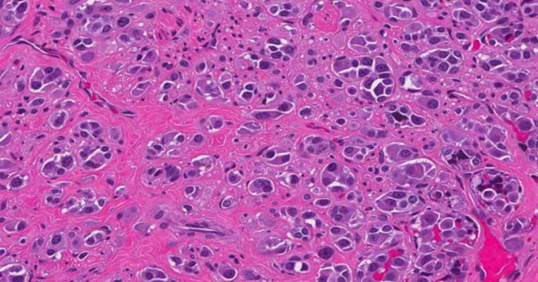 Tế bào Plasma: Nguồn gốc, đặc điểm và cơ chế tạo kháng thể