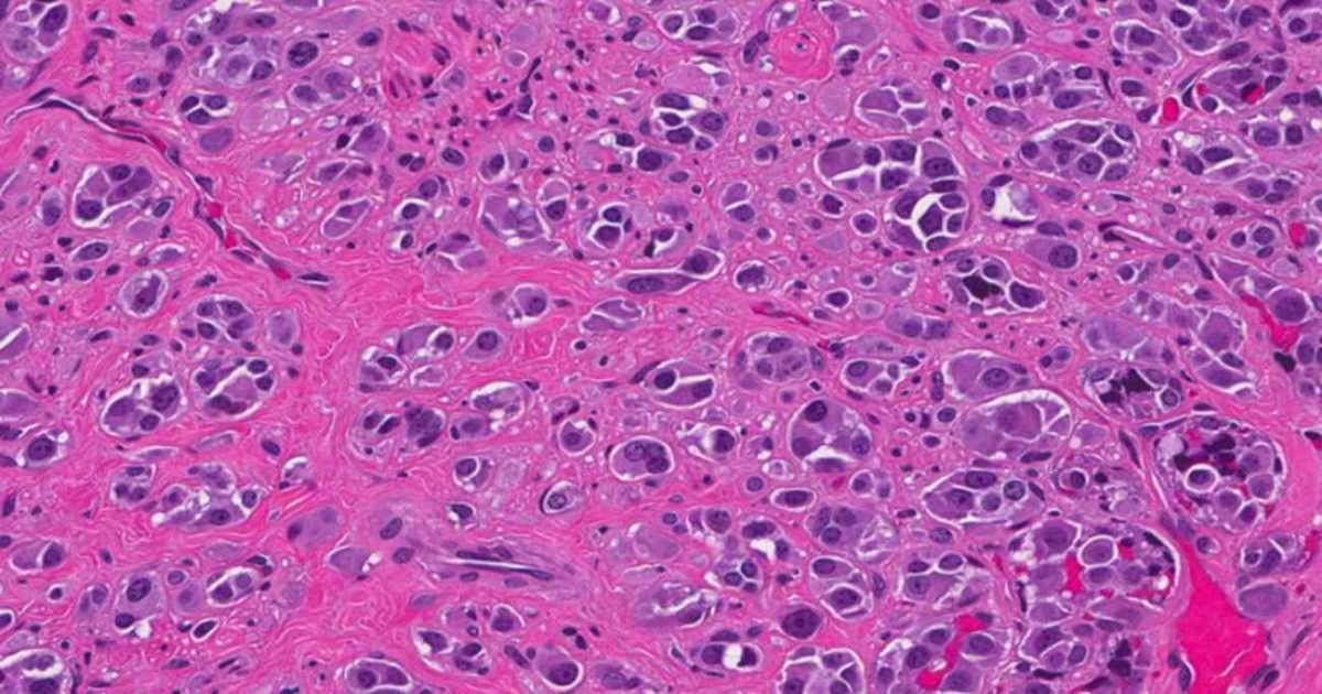 Tế bào Plasma: Nguồn gốc, đặc điểm và cơ chế tạo kháng thể