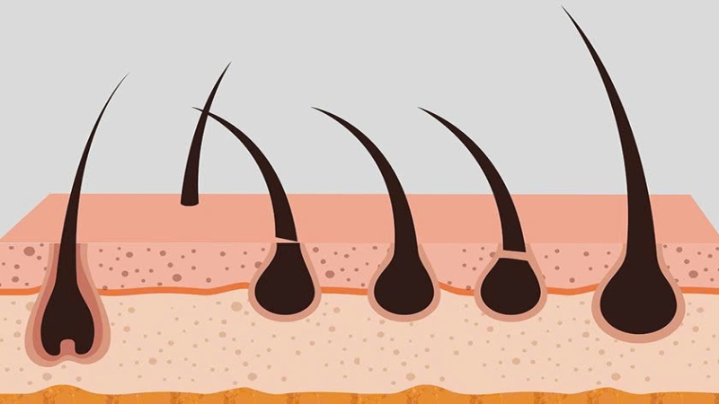 Tóc gãy rụng do đâu là băn khoăn của nhiều người (Ảnh: Sưu tầm Internet)