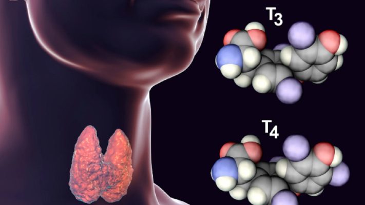 Triiodothyronine là gì